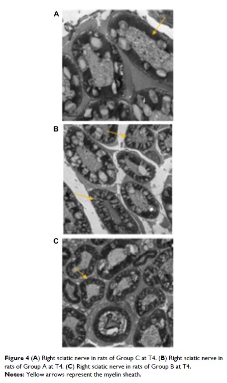 figure 4 (a) right sciatic nerve in rats of group c at t4.