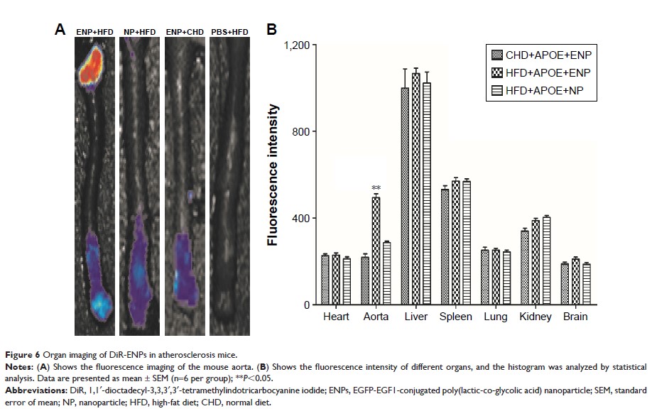 Figure 6 Organ imaging of DiR-ENPs in atherosclerosis mice.