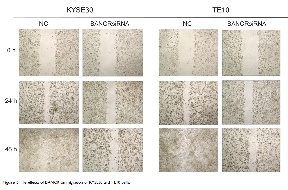 Figure 3 The effects of BANCR on migration of KYSE30 and TE10 cells.