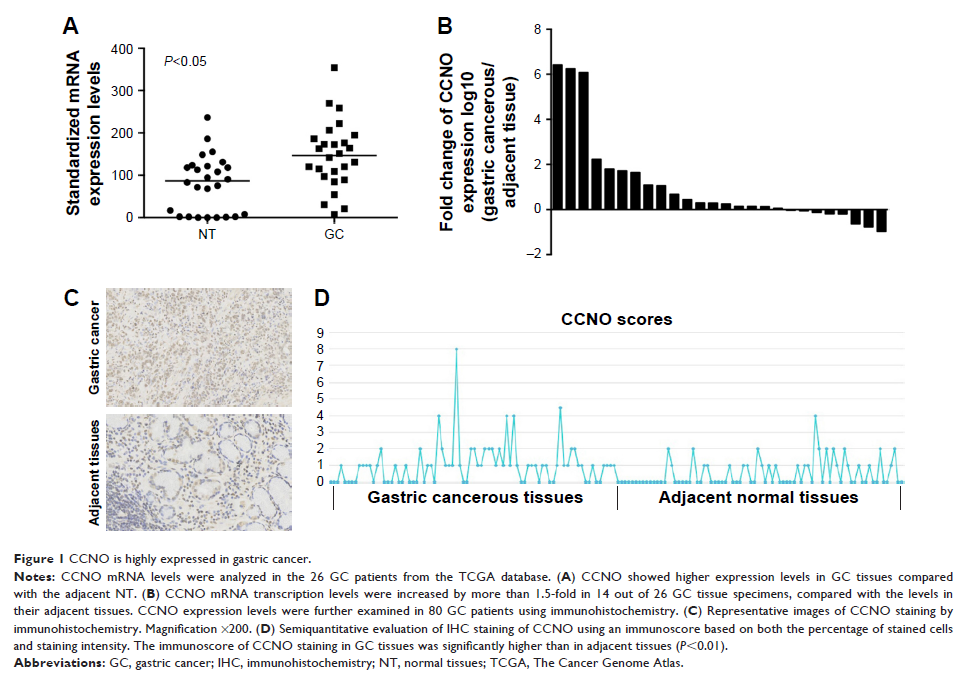 Figure 1 CCNO is highly expressed in gastric cancer.