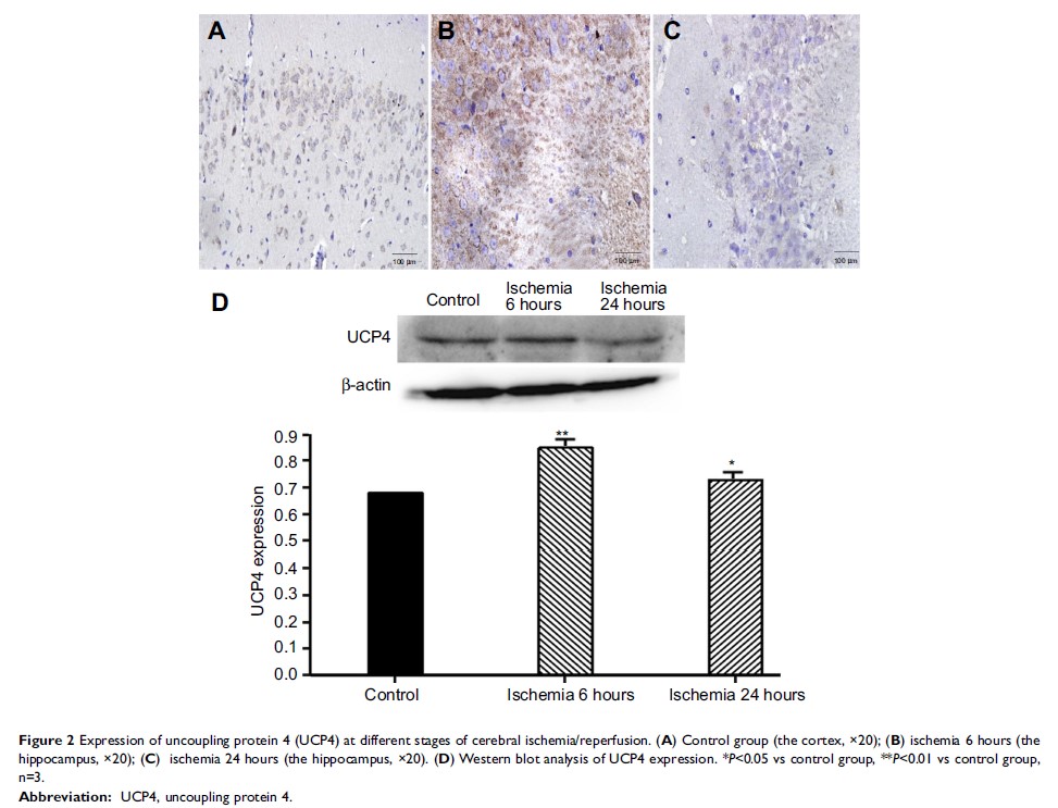 Figure 2 Expression of uncoupling protein 4 (UCP4) at different stages of cerebral ischemia/reperfusion...