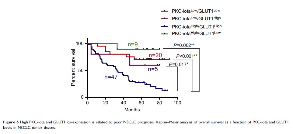 Figure 6 High PKC-iota and GLUT1 co-expression is related to...