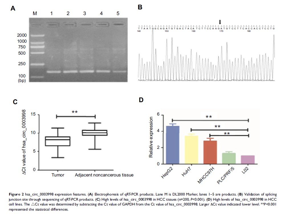 Figure 2 hsa_circ_0003998 expression features...