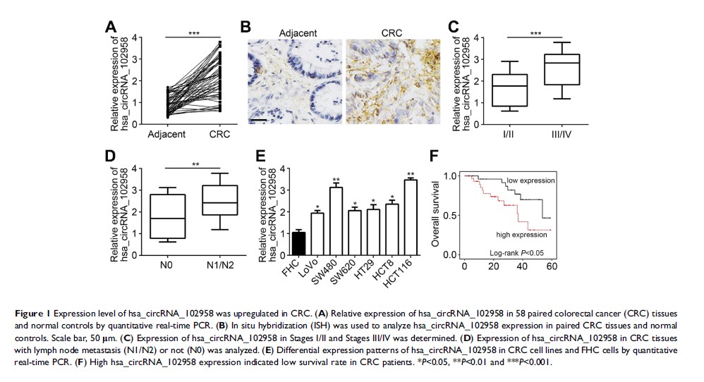 Figure 1 Expression level of hsa_circRNA_102958 was upregulated in CRC...