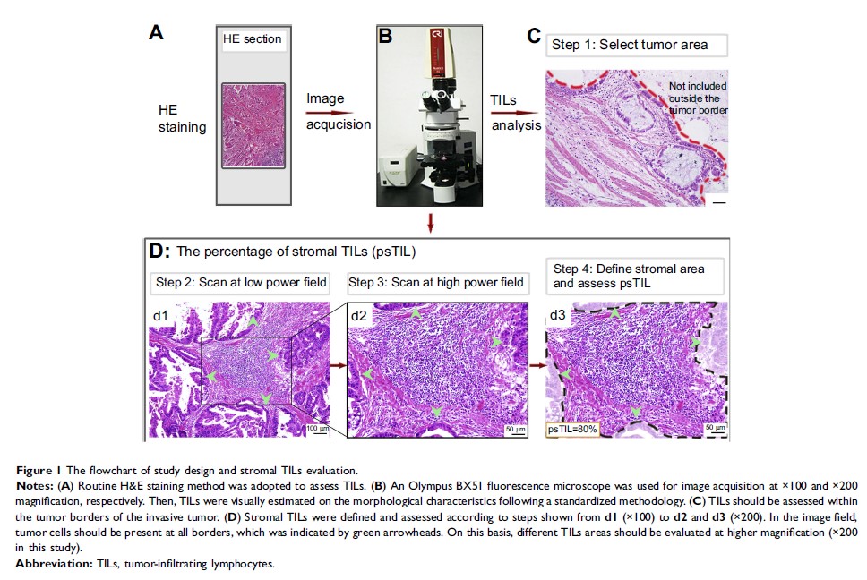 Figure 1 The flowchart of study design and stromal TILs evaluation.