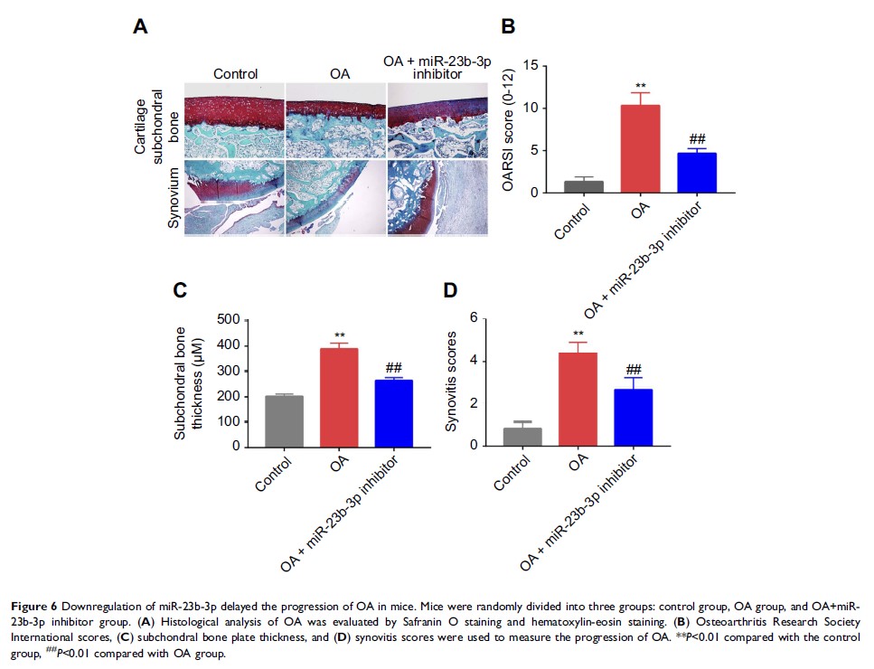 Figure 6 Downregulation of miR-23b-3p delayed the progression of OA in mice...