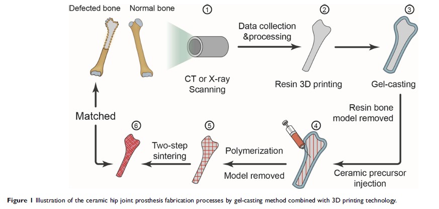 Figure 1 Illustration of the ceramic hip joint prosthesis fabrication processes by...