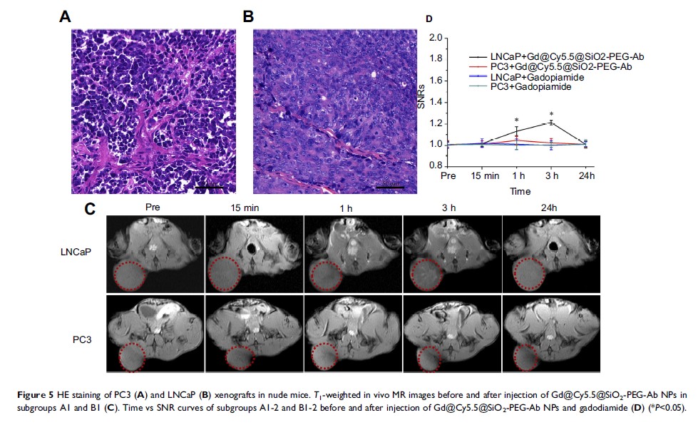 Figure 5 HE staining of PC3 (A) and LNCaP (B) xenografts in nude mice...