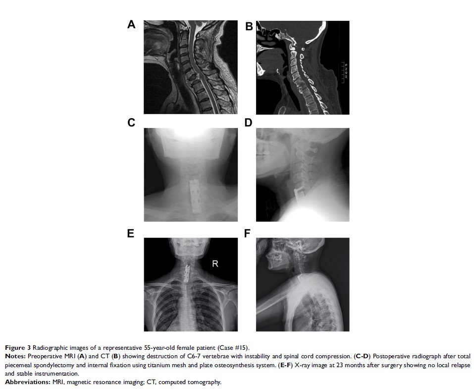 Figure 3 Radiographic images of a representative 55-year-old female patient (Case #15).