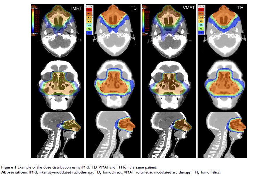 Figure 1 Example of the dose distribution using IMRT, TD, VMAT and TH for the same patient.