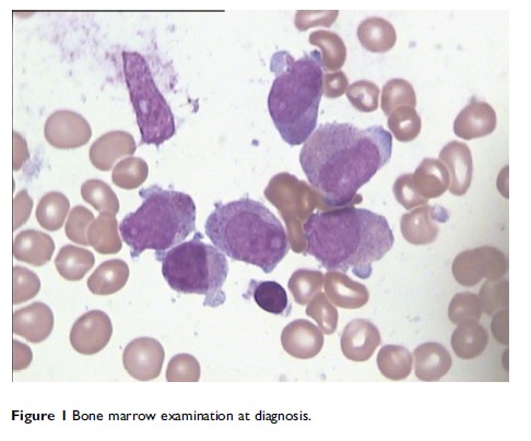 Figure 1 Bone marrow examination at diagnosis.