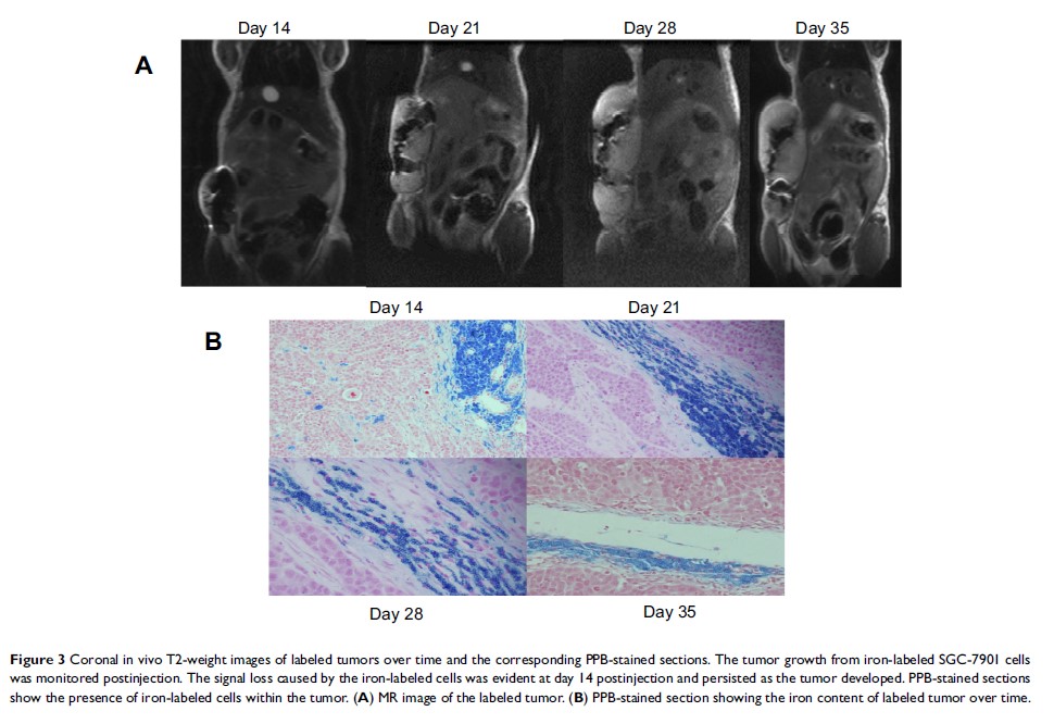 Figure 3 Coronal in vivo T2-weight images of labeled tumors over time and...