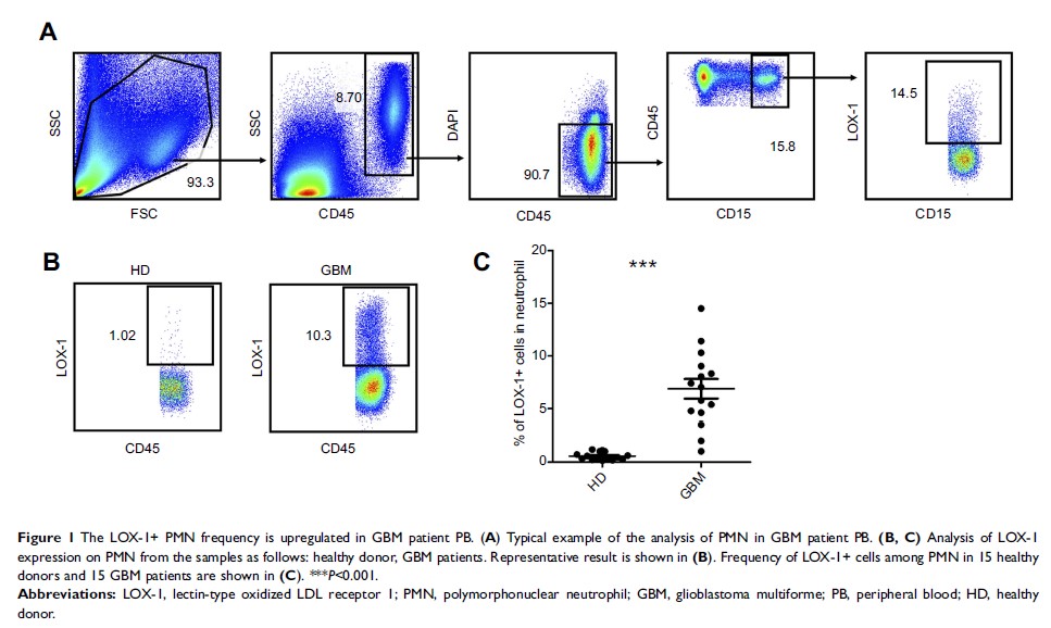 Figure 1 The LOX-1+ PMN frequency is upregulated in GBM patient PB...