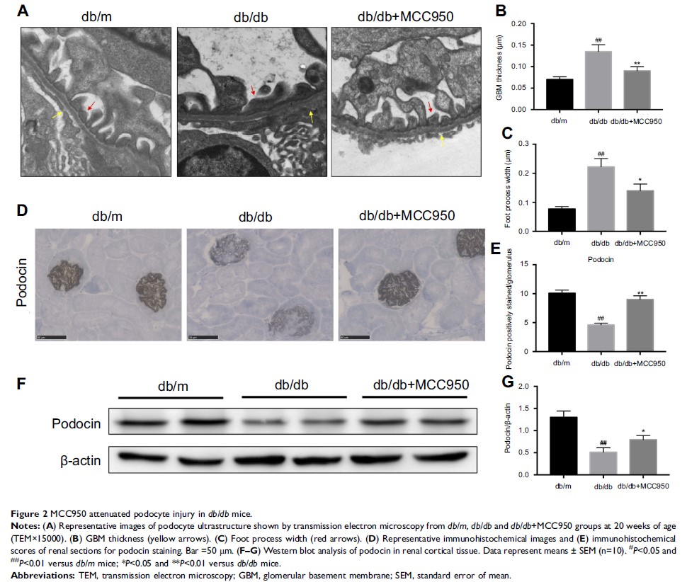 Figure 2 MCC950 attenuated podocyte injury in db/db mice.