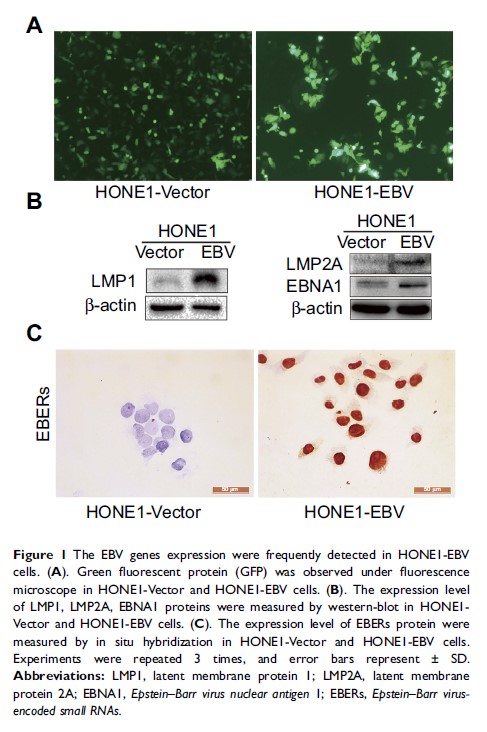 Figure 1 The EBV genes expression were frequently detected in HONE1-EBV cells...