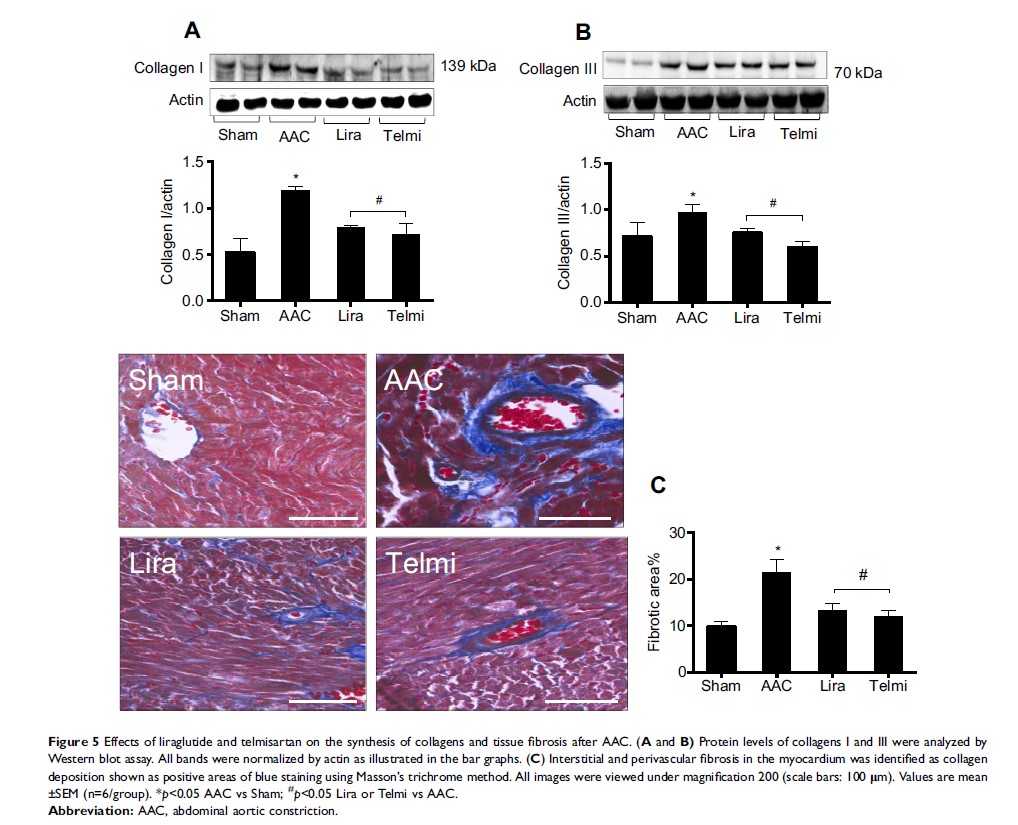 Figure 5 Effects of liraglutide and telmisartan on the synthesis of collagens and...