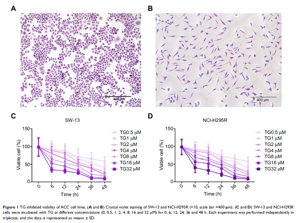 Figure 1 TG inhibited viability of ACC cell lines...