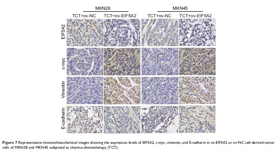 Figure 7 Representative immunohistochemical images showing the expression levels of...