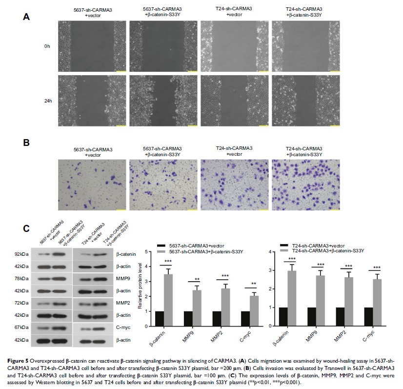 Figure 5 Overexpressed β-catenin can reactivate β-catenin signaling pathway in...