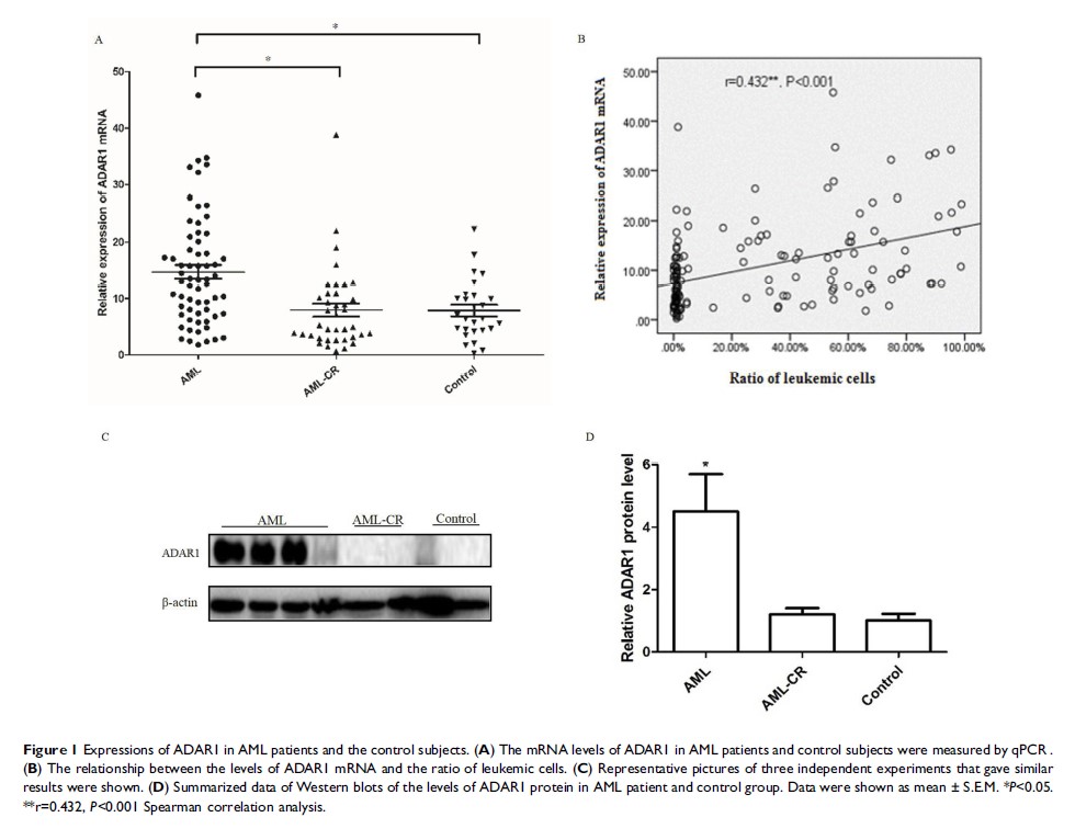 Figure 1 Expressions of ADAR1 in AML patients and the control subjects...