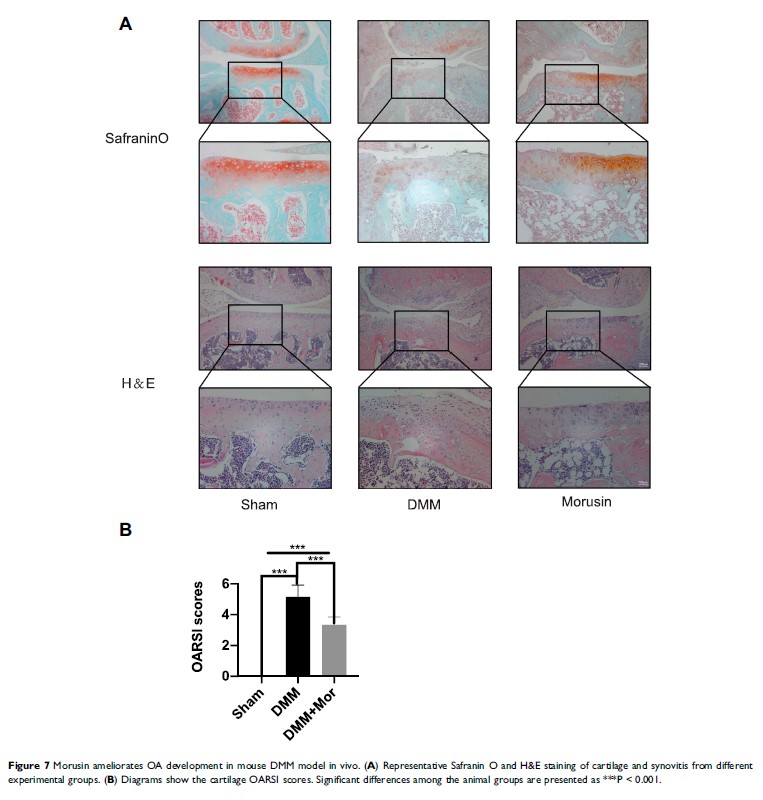 Figure 7 Morusin ameliorates OA development in... Figure 7 Morusin ameliorates OA development in...